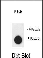 Dot blot analysis of anti-AKT1-S124 Phospho-specific Pab (Cat. #AP3715a) on nitrocellulose membrane. 50ng of Phospho-peptide or Non Phospho-peptide per dot were adsorbed. Antibody working concentrations are 0.5ug per ml.