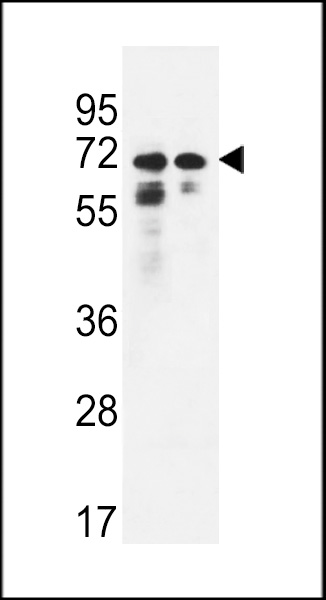 PNPLA8 Antibody (N-term) (Cat. #AP4706a) western blot analysis in Hela,K562 cell line lysates (35ug/lane).This demonstrates the PNPLA8 antibody detected the PNPLA8 protein (arrow).