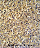IHC-P - CRIP1 Antibody (C-term) AP4707b