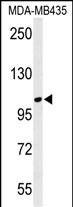 WB - LUZP1 Antibody (C-term) AP4711b