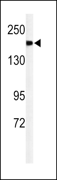 Western blot analysis of A2ML1 Antibody (N-term) (Cat. #AP4723a) in mouse lung tissue lysates (35ug/lane). A2ML1 (arrow) was detected using the purified Pab.