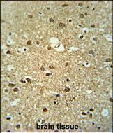 IHC-P - MMGT1 Antibody (C-term) AP4731B