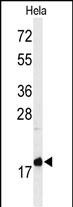 WB - MMGT1 Antibody (C-term) AP4731B