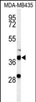 Western blot analysis of DHRS7 Antibody (N-term) (Cat. #AP4772a) in MDA-MB435 cell line lysates (35ug/lane). DHRS7 (arrow) was detected using the purified Pab.