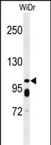 Western blot analysis of ABCC11 Antibody (N-term) (Cat. #AP4787a) in WiDr cell line lysates (35ug/lane). ABCC11 (arrow) was detected using the purified Pab.