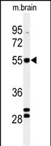 WB - FA2H Antibody (Center) AP4799c