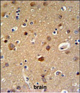 IHC-P - TELO2 Antibody (C-term) AP4808b