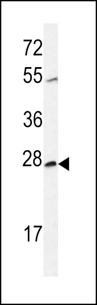 Western blot analysis of CWC15 Antibody (Center) (Cat. #AP4809c) in CHO cell line lysates (35ug/lane). CWC15 (arrow) was detected using the purified Pab.