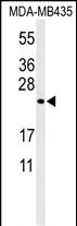 Western blot analysis of ZCH24 Antibody  (C-term) (Cat. #AP4843b) in MDA-MB435 cell line lysates (35ug/lane). ZCH24 (arrow) was detected using the purified Pab.