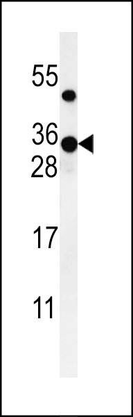 WB - ZCH24 Antibody  (C-term) AP4843b