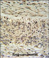 IHC-P - DDX23 Antibody (Center) AP4866c