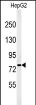Western blot analysis of YMEL1 Antibody (N-term) (Cat. #AP4882a) in HepG2 cell line lysates (35ug/lane). YMEL1 (arrow) was detected using the purified Pab.