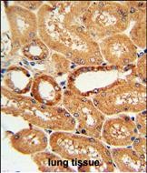 IHC-P - COQ9 Antibody (Center) AP4890c