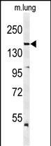 Western blot analysis of KDR (Y1175) Antibody (Cat. #AP7643c) in mouse lung tissue lysates (35ug/lane). KDR (arrow) was detected using the purified Pab.