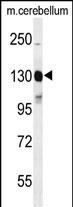 Western blot analysis of  KIT Antibody (Y703) (Cat. #AP7656g) in mouse cerebellum tissue lysates (35ug/lane). KIT (arrow) was detected using the purified Pab.