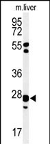 Western blot analysis of GSTK1 Antibody (Center) (Cat. #AP9867c) in mouse liver tissue lysates (35ug/lane). GSTK1 (arrow) was detected using the purified Pab.