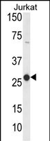 Western blot analysis of CD160 Antibody (Center) (Cat. #AP9869c) in Jurkat cell line lysates (35ug/lane). CD160 (arrow) was detected using the purified Pab.