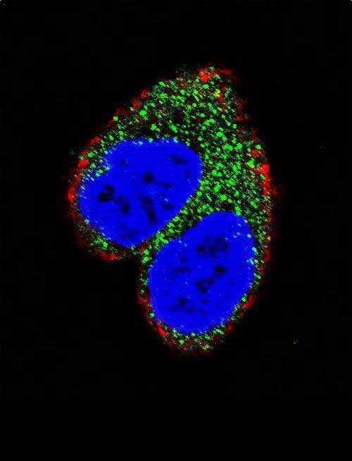 Confocal immunofluorescent analysis of AIM2 Antibody (N-term)(Cat#AP9876a) with MCF-7 cell followed by Alexa Fluor 488-conjugated goat anti-rabbit lgG (green).Actin filaments have been labeled with Alexa Fluor 555 phalloidin (red).DAPI was used to stain the cell nuclear (blue).