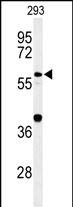 Western blot analysis of CDC45L Antibody (Center) (Cat. #AP9881c) in 293 cell line lysates (35ug/lane). CDC45L (arrow) was detected using the purified Pab.