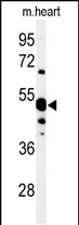 Western blot analysis of 5NT1A Antibody (N-term) (Cat. #AP9917a) in mouse heart tissue lysates (35ug/lane). 5NT1A (arrow) was detected using the purified Pab.