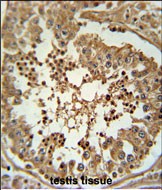 IHC-P - CC058 Antibody (Center) AP9931c