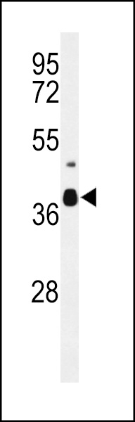 WB - CC058 Antibody (Center) AP9931c