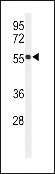 Western blot analysis of HIAT1 Antibody  (C-term) (Cat. #AP9975b) in mouse kidney tissue lysates (35ug/lane). HIAT1 (arrow) was detected using the purified Pab.