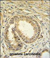 IHC-P - SPDYA Antibody (Center) AP9978a