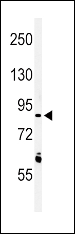 WB - LRRN3 Antibody (N-term) AP4916A