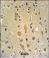 IHC-P - APITD1 Antibody (Center) AP4921c