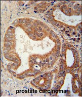 IHC-P - CSGALNACT1 Antibody (Center) AP4922c