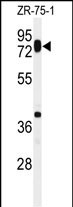 Western blot analysis of HAS1 Antibody (Center) (Cat. #AP4928c) in ZR-75-1 cell line lysates (35ug/lane). HAS1 (arrow) was detected using the purified Pab.