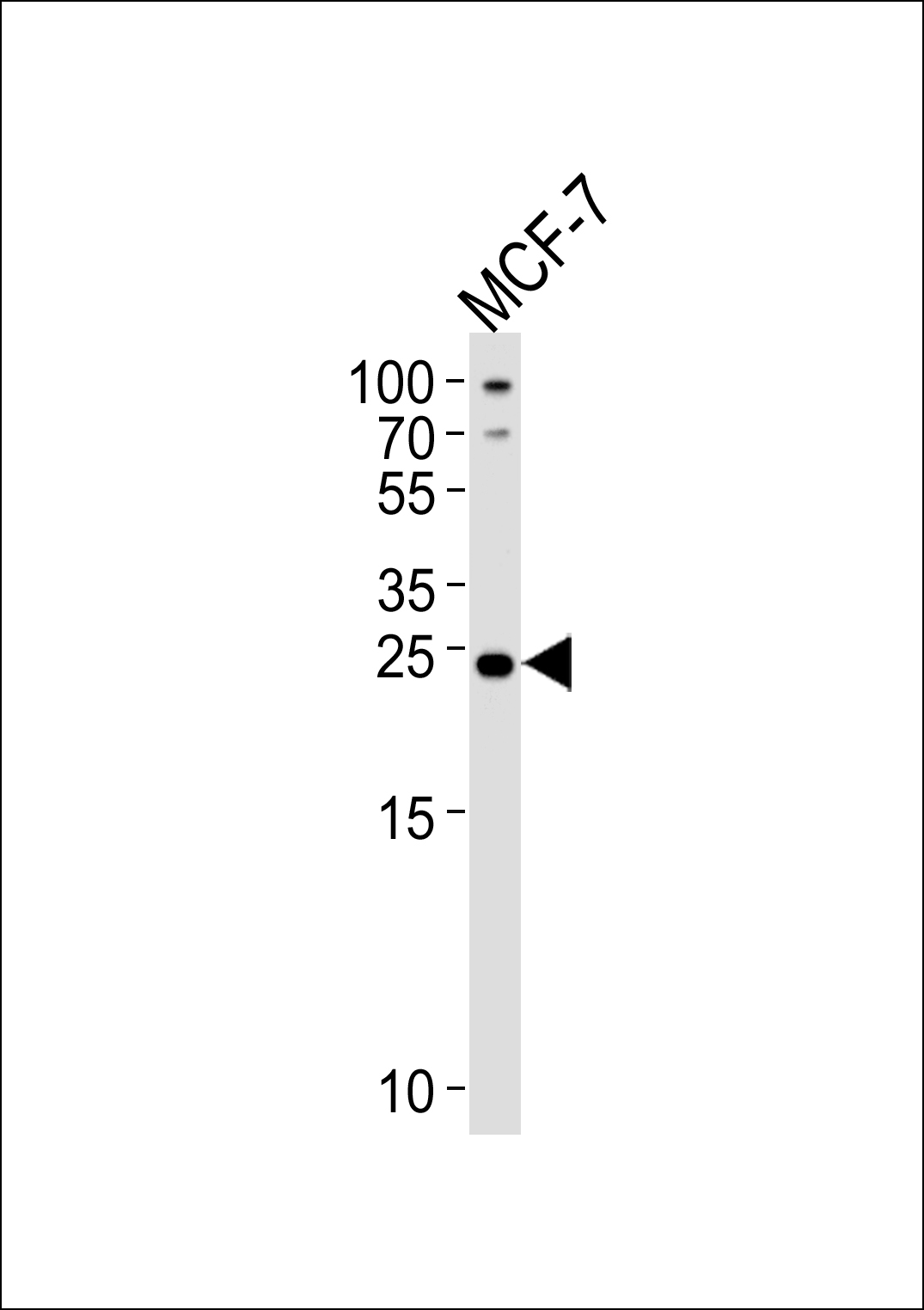WB - PTPLB Antibody (C-term) AP4975b