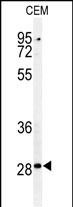 Western blot analysis of CASP3 (Asp175) Antibody (Cat. #AP4985d) in CEM cell line lysates (35ug/lane). CASP3 (arrow) was detected using the purified Pab.