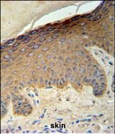 IHC-P - KRT35 Antibody (C-term) AP4993b