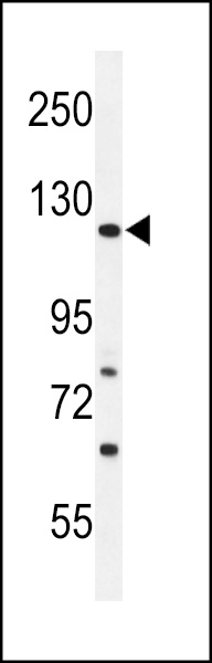 WB - ARHGAP30 Antibody (C-term) AP4996b