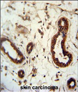 IHC-P - KRT82 Antibody (Center) AP5049c