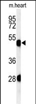 WB - KRT82 Antibody (Center) AP5049c