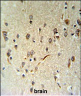 IHC-P - LIMD2 Antibody (N-term) AP5051a