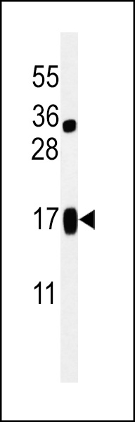 WB - LIMD2 Antibody (N-term) AP5051a