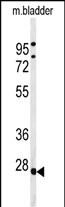 WB - TPRGL Antibody  (N-term) AP5083a