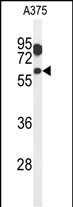 WB - ZACN Antibody (C-term) AP5090b