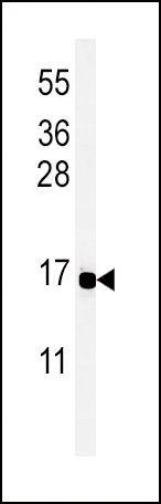 WB - PYY Antibody (C-term) AP5103B