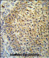 IHC-P - TM222 Antibody (Center) AP5130c