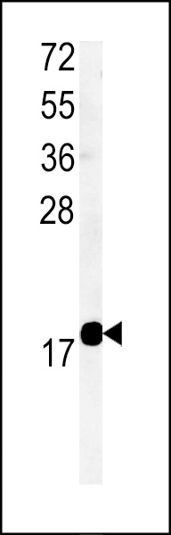 WB - TM222 Antibody (Center) AP5130c