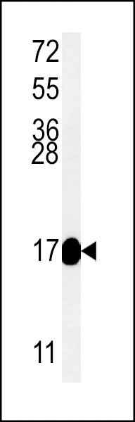 Western blot analysis of RT33 Antibody (C-term) (Cat. #AP5131b) in mouse kidney tissue lysates (35ug/lane).RT33 (arrow) was detected using the purified Pab.