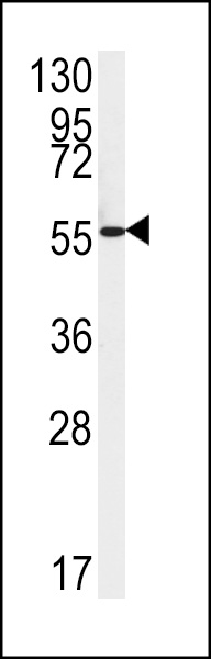 Western blot analysis of FAAH2 Antibody (C-term) (Cat. #AP5150b) in HepG2 cell line lysates (35ug/lane).FAAH2 (arrow) was detected using the purified Pab.