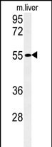 WB - FAM151A Antibody (C-term) AP5152b