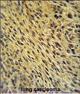 IHC-P - CCDC62 Antibody (C-term) AP5157b