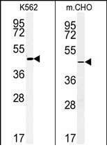 (LEFT)Western blot analysis of ENTPD8 Antibody (C-term) (Cat. #AP5161b) in K562 cell line lysates (35ug/lane).ENTPD8 (arrow) was detected using the purified Pab.(RIGHT)Western blot analysis of ENTPD8 Antibody (C-term) (Cat. #AP5161b) in CHO cell line lysates (35ug/lane).ENTPD8 (arrow) was detected using the purified Pab.